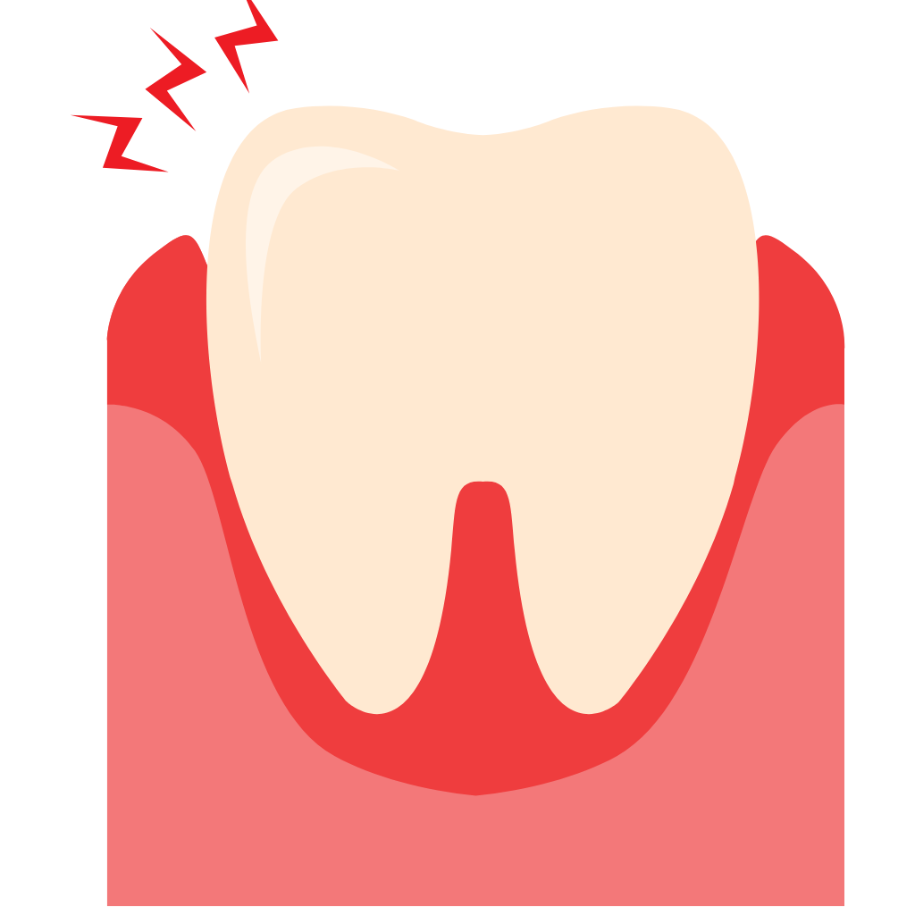 Dental Abscess Treatment